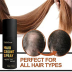 Hair Growth Spray 50ml
