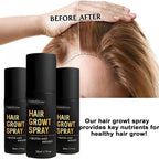 Hair Growth Spray 50ml